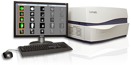 THE CELLTRACKS ANALYZER II THE CELLTRACKS ANALYZER II